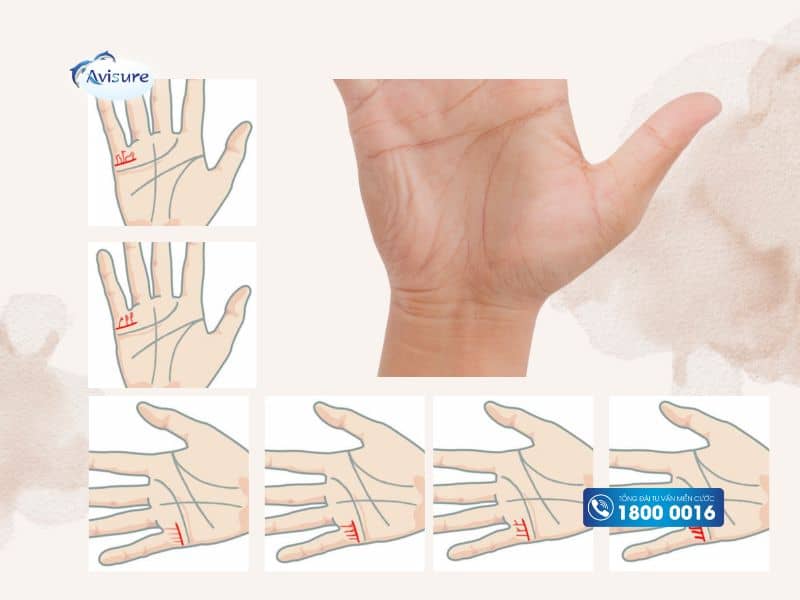 Xem trai hay gái ở vị trí dưới ngón út